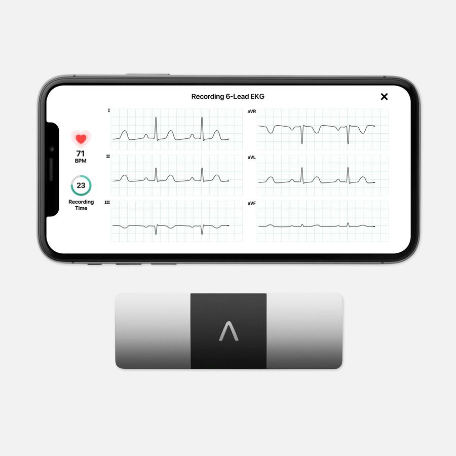 AliveCor KardiaMobile Personal EKG 6L, , large image number 0